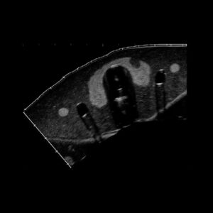 échographie structures internes fantôme d'entraînement biopsie thyroïde
